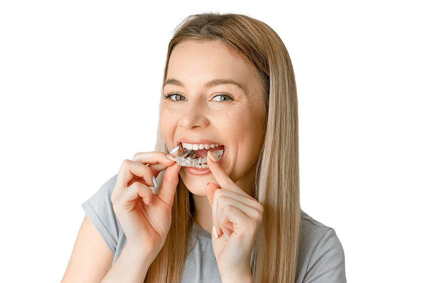 Why Angel Aligners are the smart choice