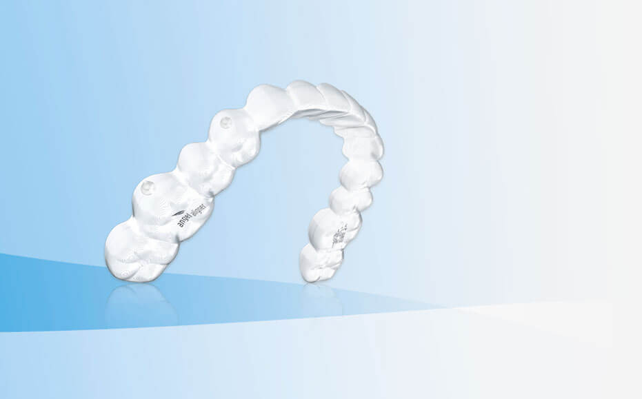 Invisalign® vs Angel Aligners – which should you choose?
