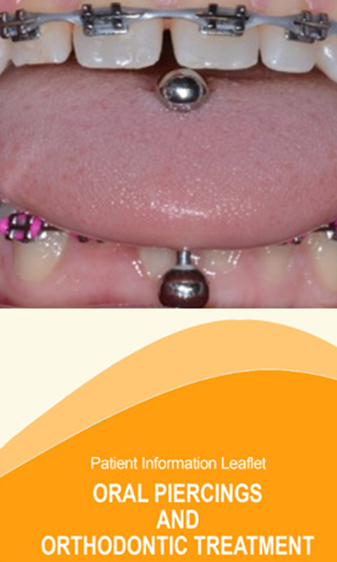 Oral piercing and Orthodontic treatment