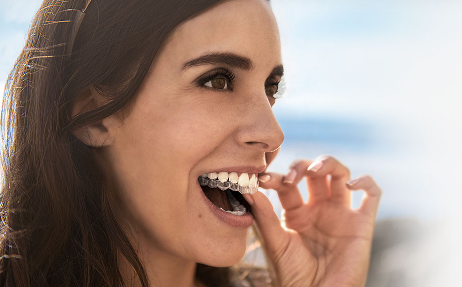 Invisalign