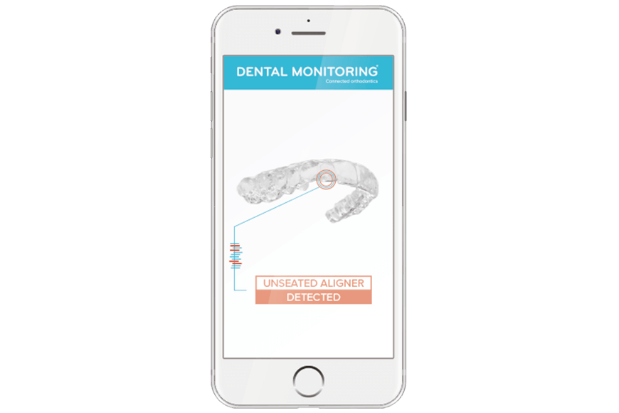 Dental Monitoring